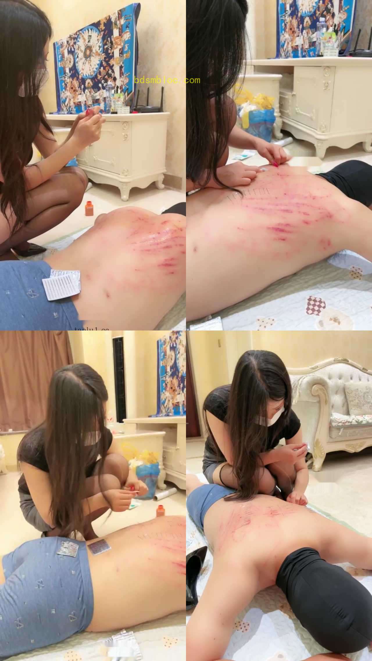 【西北傻子】重度刑过后的残忍穿刺花背